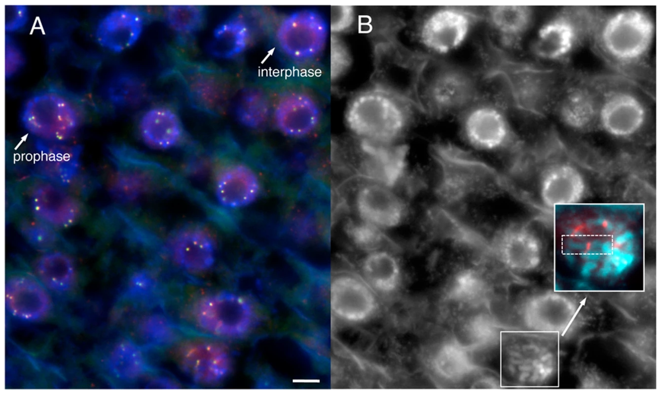 YFP–CENPC localizes to kinetochores.