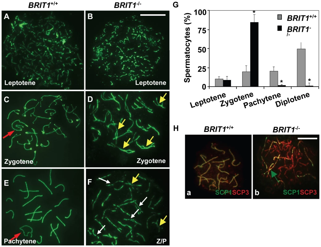 Meiosis in <i>BRIT1</i>-deficient spermatocytes was arrested prior to the pachytene stage with aberrant chromosomal synapsis.