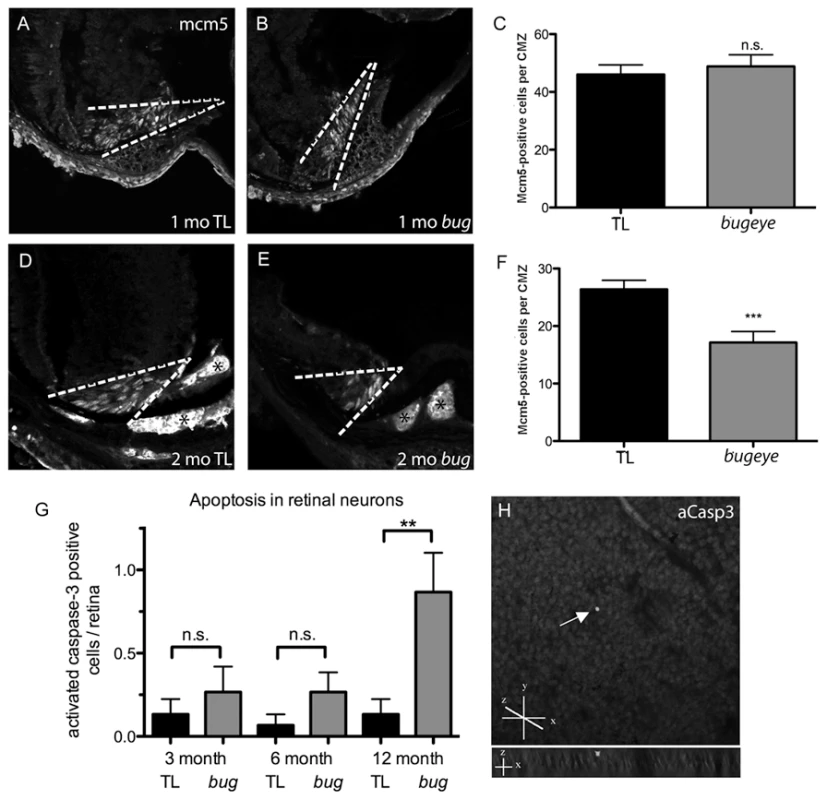 Retinal proliferation and apoptosis.