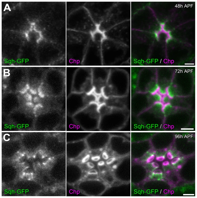 Sqh localization during retinal lumen formation.