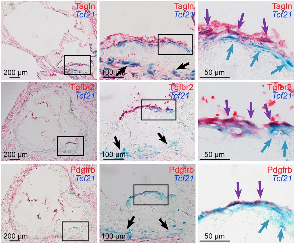 <i>Tcf21</i> expressing cells associate with the fibrous cap.