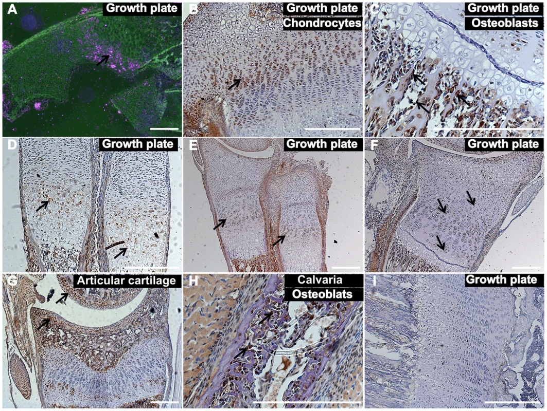 <i>Tnni2</i> was expressed in chondrocytes and osteoblasts.