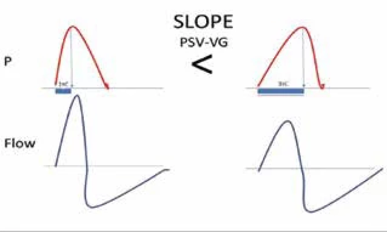 Tlakové a průtokové křivky v závislosti na velikosti parametru SLOPE