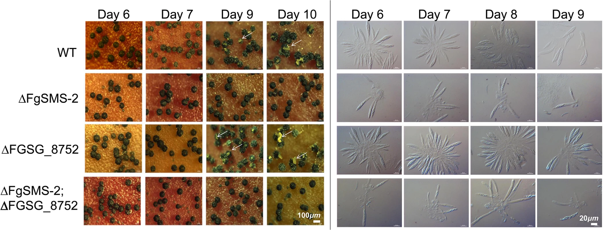 Perithecia formation and ascus/ascopore development in the single gene deletion- (Δ<i>FgSMS-2</i> and ΔFGSG_08752, respectively) and double gene deletion-strains (Δ<i>FgSMS-2</i>;ΔFGSG_8752) grown on carrot agar.