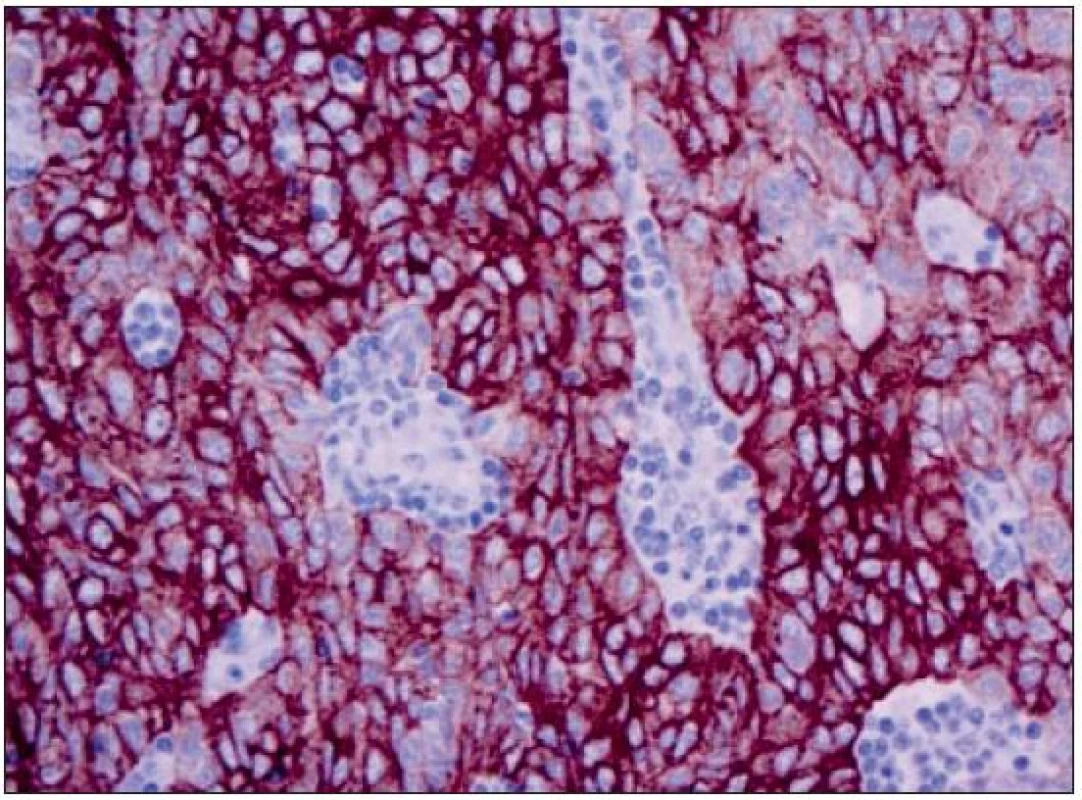 Imunohistochemický průkaz širokospektrých cytokeratinů
