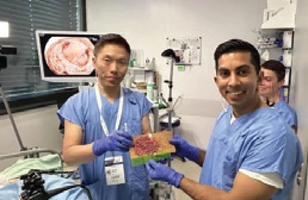OLE 2025 – prof. Hiroyuki Aihara a dr. Daryl Ramai po ESD v rektu. Výsledný resekát velikosti 11 × 8 cm. Fig. 􀍷􀍷. OLE 2025 – Prof. Hiroyuki Aihara and Dr. Daryl Ramai after ESD in the rectum. The resulting resected specimen measures 11 × 8 cm.