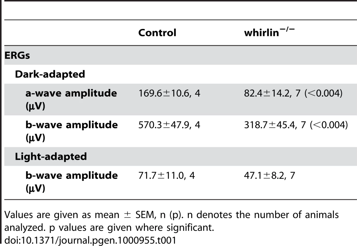 ERG analysis in whirlin knockout mice at 28–33 months of age.