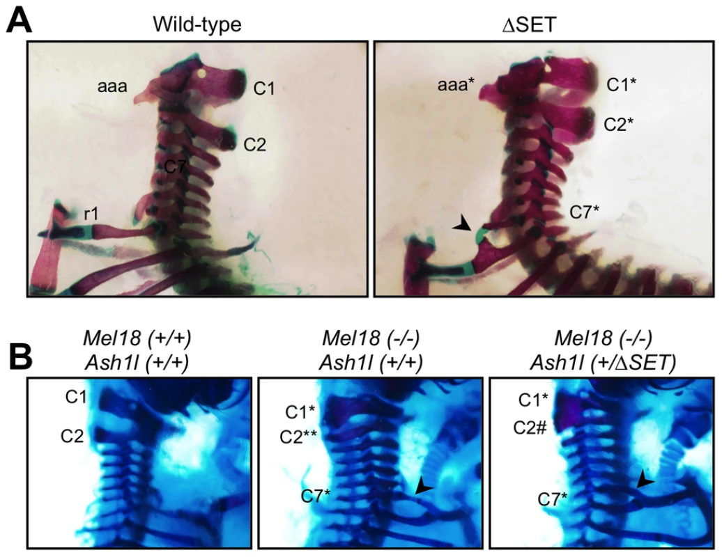 Typical skeletal phenotypes of <i>Ash1l</i> ΔSET mice, and a genetic interaction between <i>Ash1l</i> and <i>Mel18</i>.