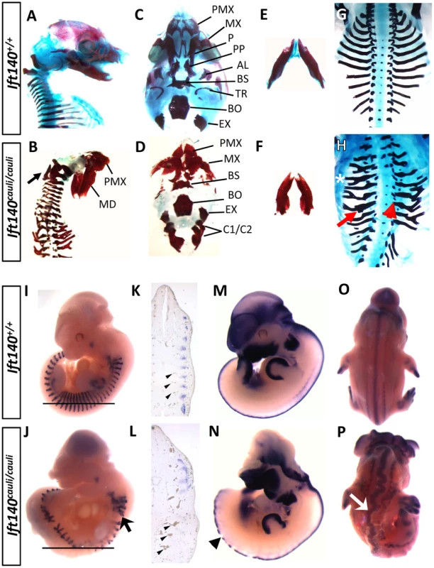 <i>Ift140<sup>cauli/cauli</sup></i> embryos exhibit skeletal, somite and neural tube defects.