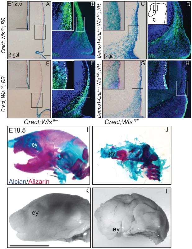 Deletion of <i>Wntless</i> in the cranial ectoderm and mesenchyme.