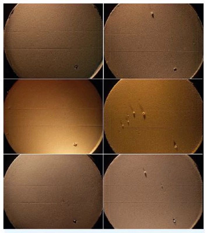 Kvalita povrchu a reprodukce 50mm rýhy sádrových modelů odlitých z kontrolních vzorků (vlevo) a ze zkušebních vzorků po jejich dezinfekci v přípravku Silosept (vpravo); nahoře – sádrové modely vzorků z otisk. hmotyYpeen, uprostřed – sádrové modely vzorků z Alligat fast set, dole – sádrové modely vzorků z Elastic Cromo; zvětšení 6,3x