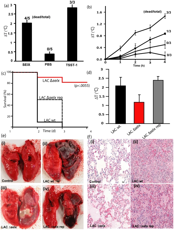 SElX causes TSS and contributes to the severity and lethality of necrotizing pneumonia caused by CA-MRSA USA300.