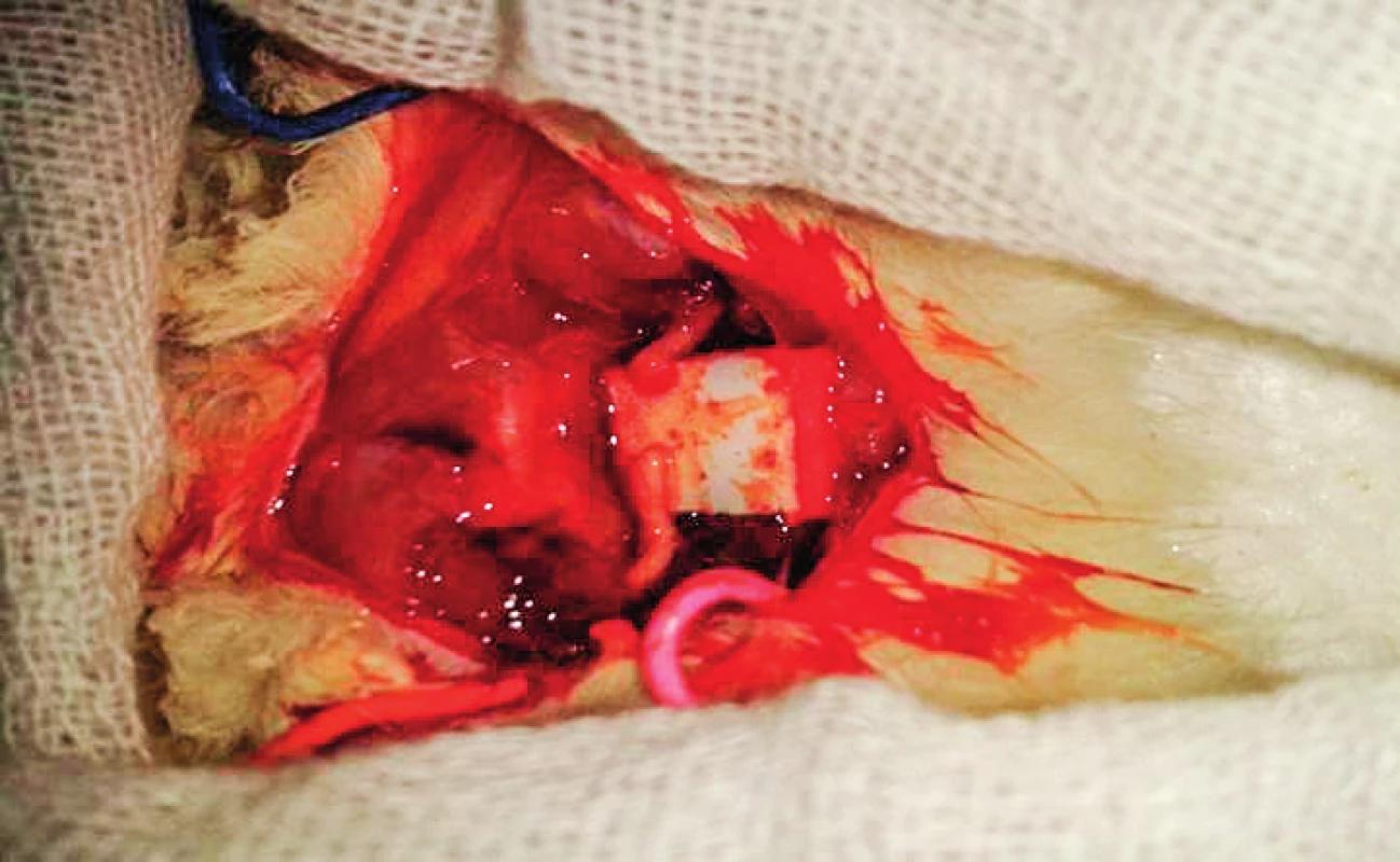 Exposed transected sciatic nerve