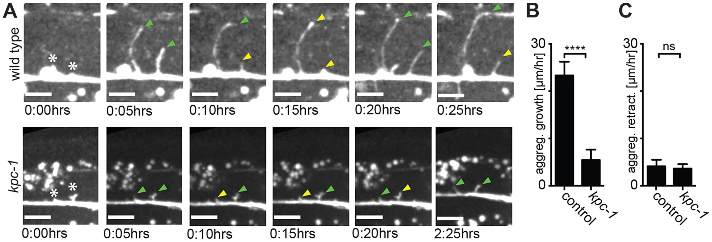 Dendrites in <i>kpc-1</i> display decreased speed of growth.