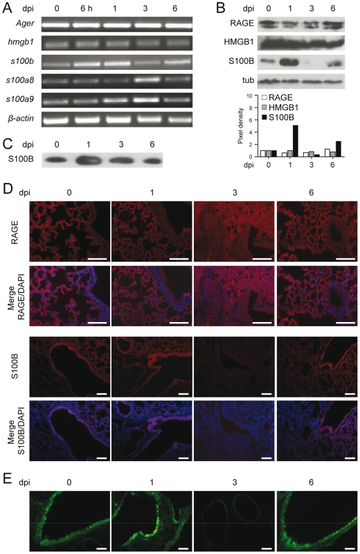 RAGE and DAMPs expression in pulmonary aspergillosis.