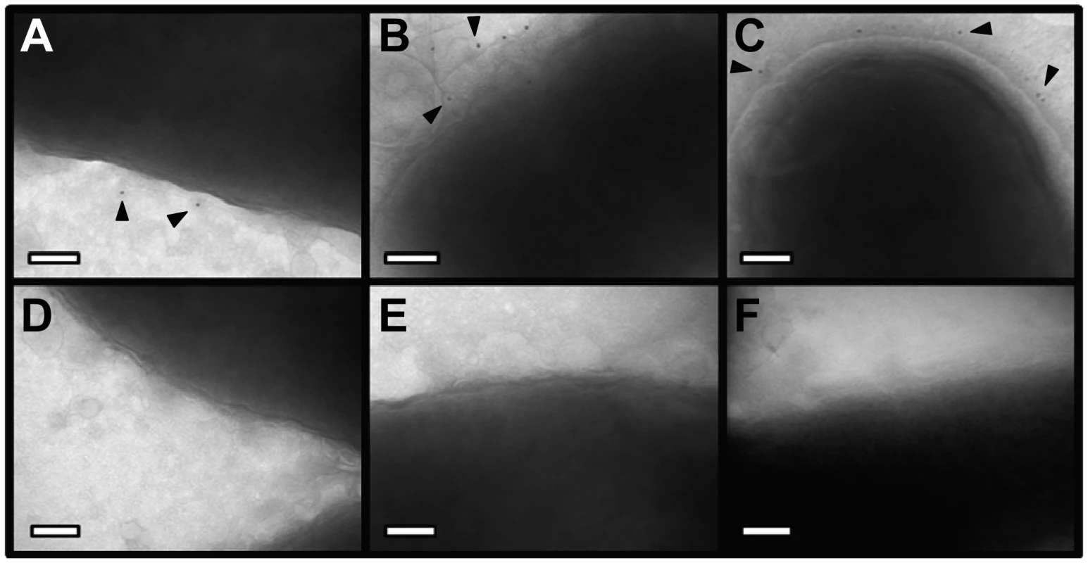 Immunoelectron microscopy analysis of whole bacterial cells.