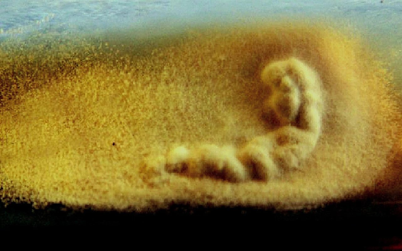 Arthrographis kalrae, kolónia (Sabouraudov agar, 3 týždne, 25 °C)
Fig. 1. Arthrographis kalrae, a colony (Sabouraud agar, 3 weeks, 25°C)