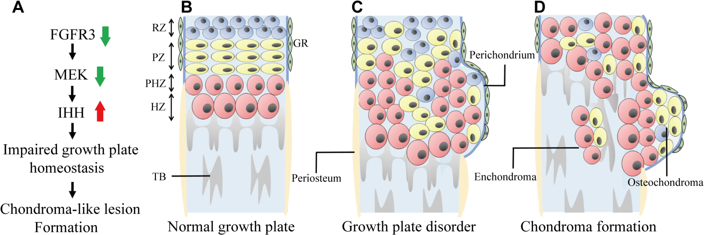 Model of chondroma-like lesion formation in <i>Fgfr3</i> cKO mice.