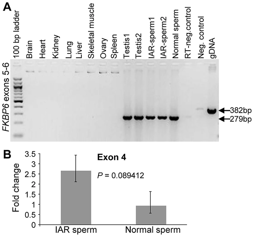 Expression analysis of equine <i>FKBP6</i>.