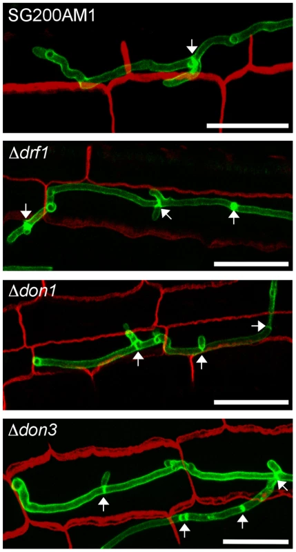 Septum formation of <i>drf1</i>, <i>don1</i> and <i>don3</i> deletion mutants in planta.