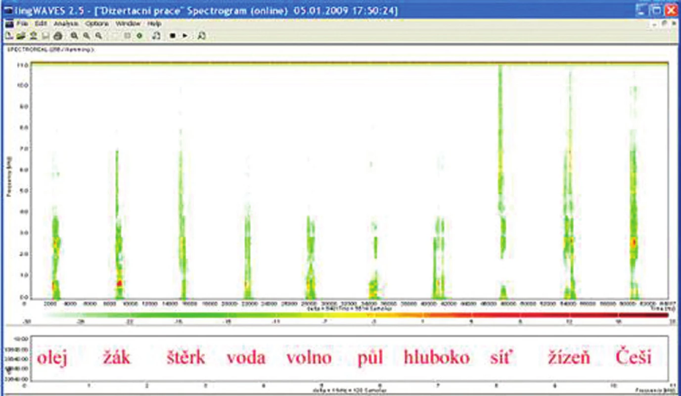 Sonogram slovní audiometrie, dekáda slov 65 dB na pozadí ticha.