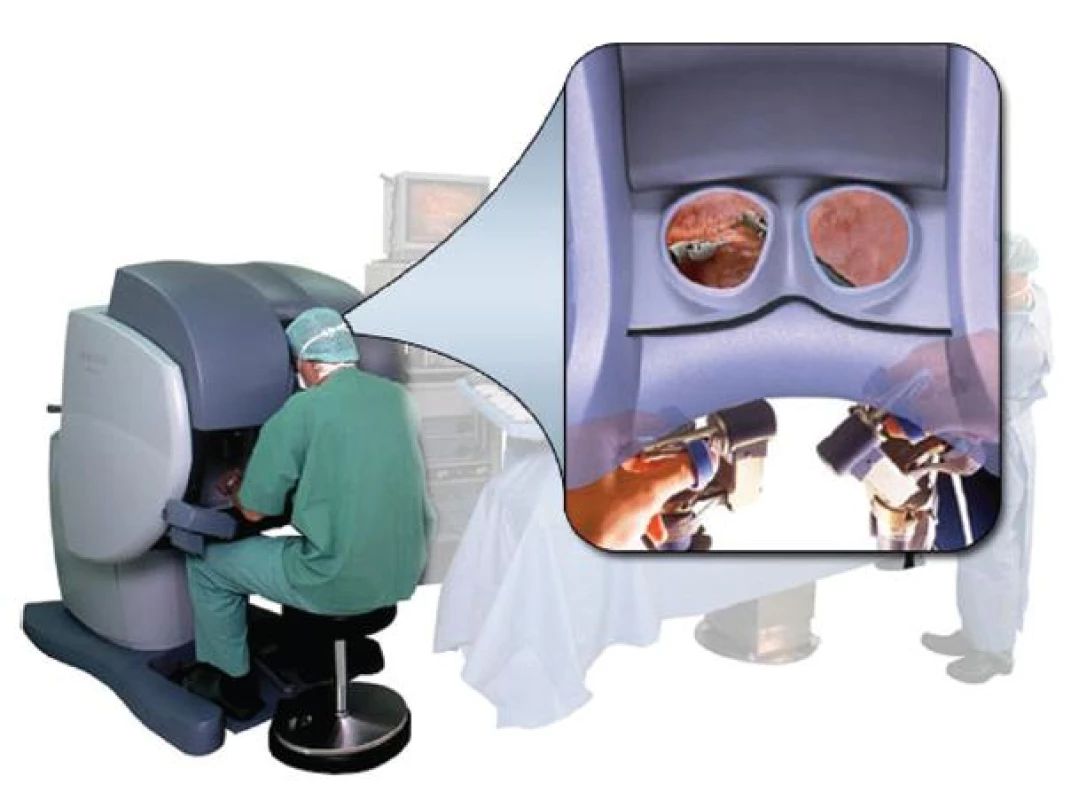 Chirurg při operaci
Fig. 2: The robotic surgeon