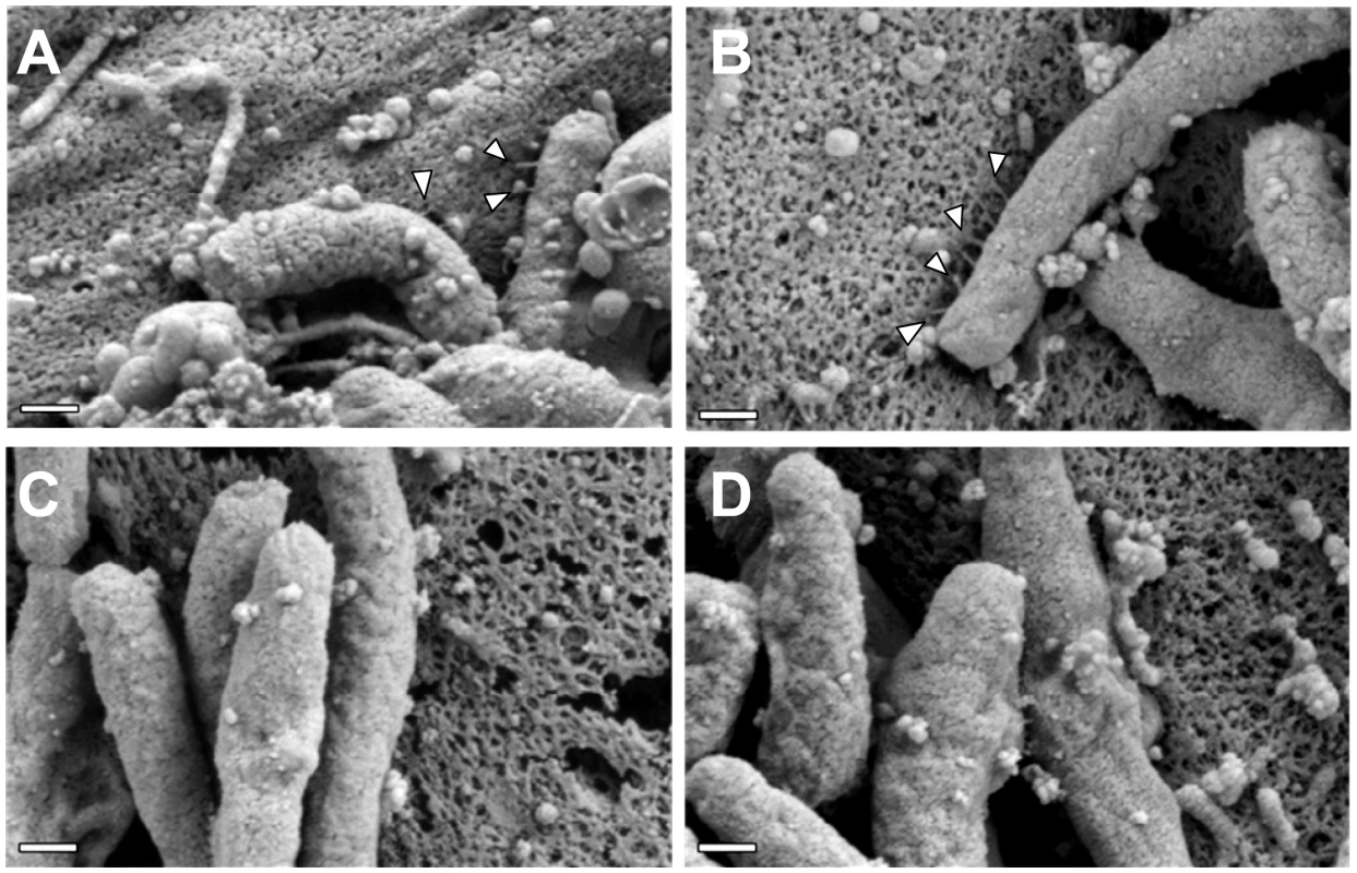 The C-terminal motif of CagI and CagL is required for pilus formation.