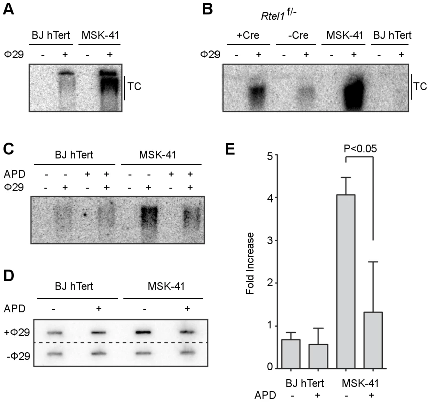 Inhibiting DNA replication blocks T-circle formation in MSK-41 <i>RTEL1<sup>R1264H</sup></i> cells.