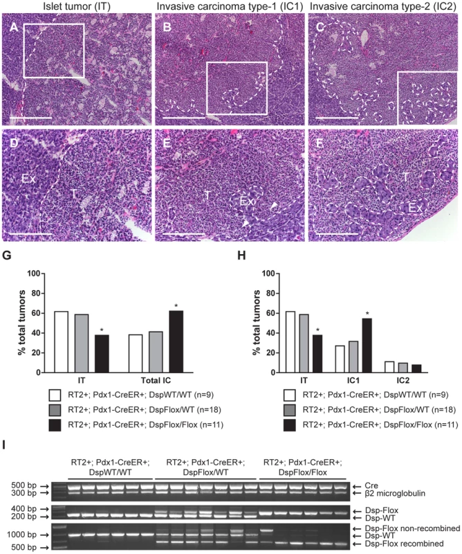Genetic deletion of <i>desmoplakin</i> leads to increased local tumor invasion in <i>RT2</i> mice.
