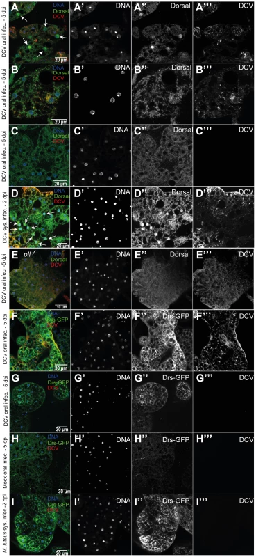 Toll pathway activation by DCV infection.