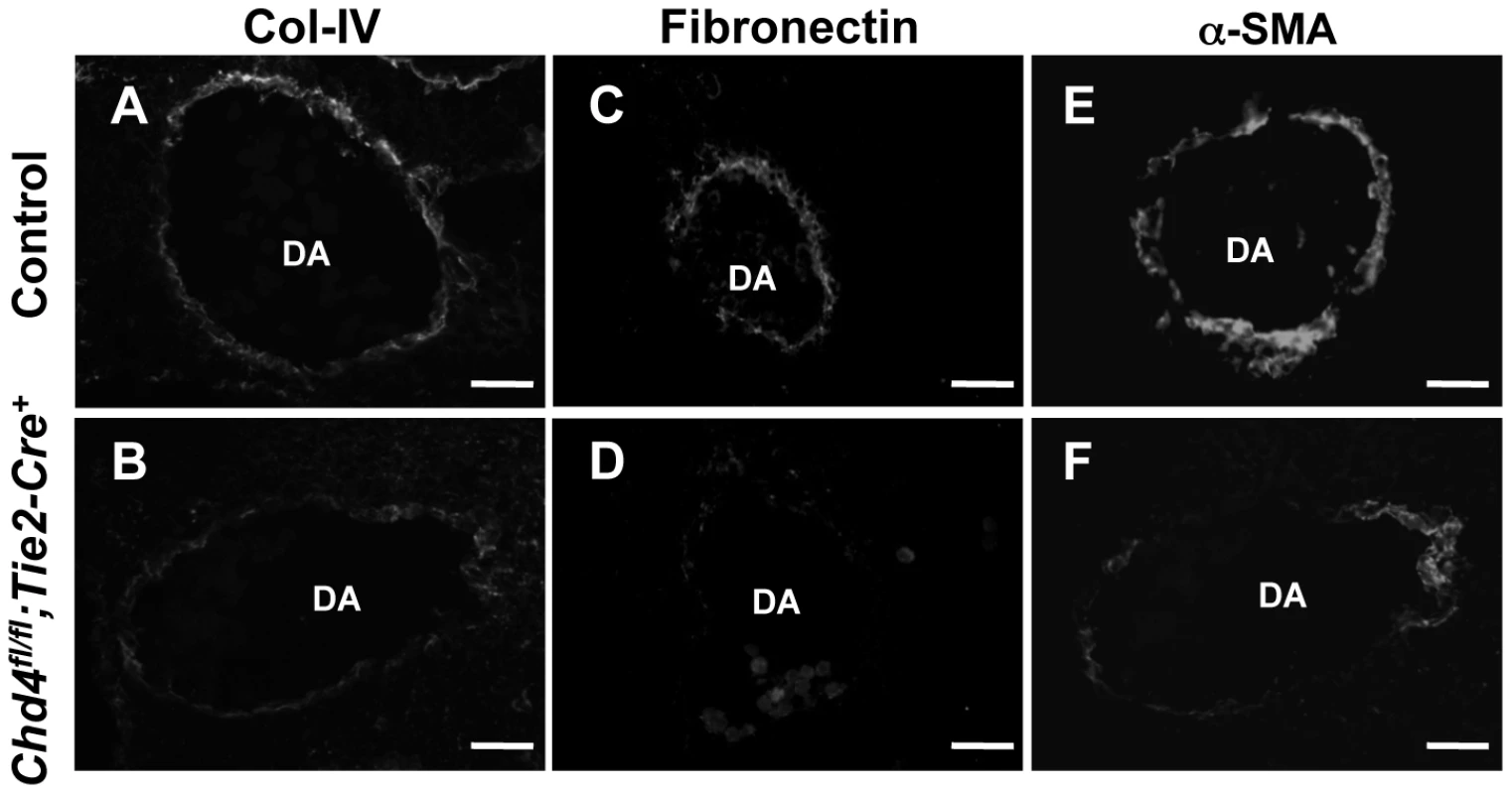 Extracellular matrix (ECM) components are diminished around <i>Chd4<sup>fl/fl</sup>;Tie2-Cre<sup>+</sup></i> vessels prior to rupture.
