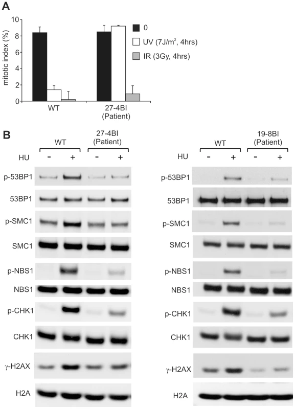 LBLs from patient 27-4BI and 19-8BI showed impaired ATR–dependent damage responses.
