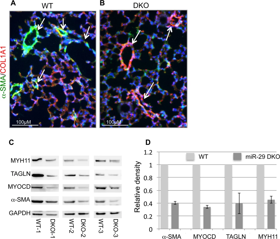 Disruption of miR-29 expression <i>in vivo</i> leads to aberrant vSMC differentiation.