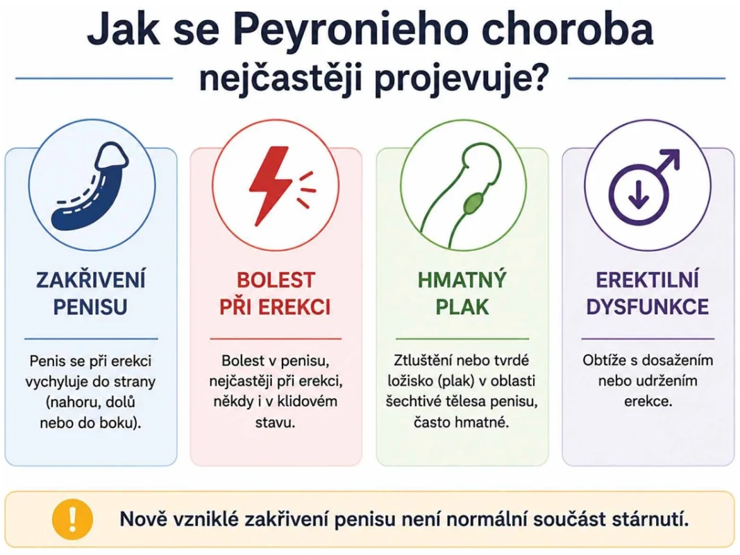 Klinické projevy Peyronieho choroby