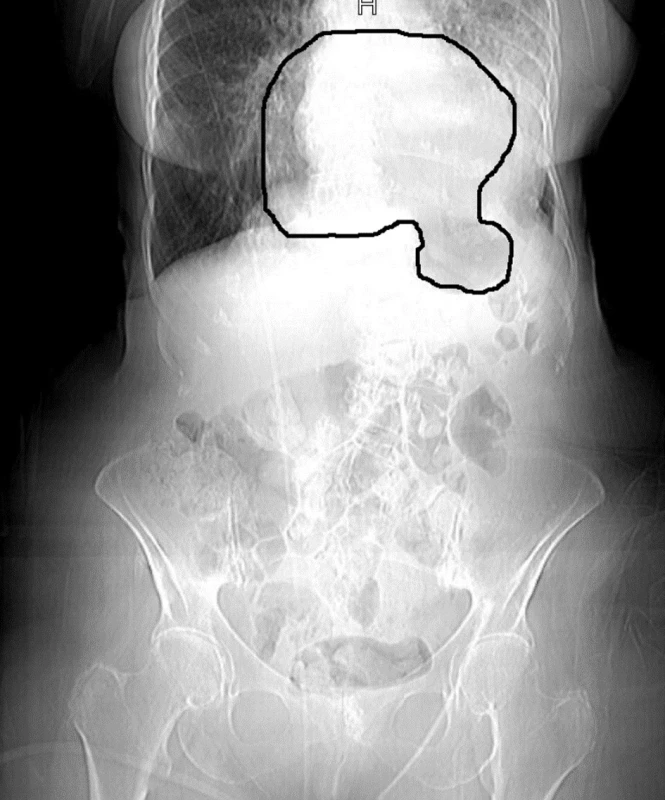Rtg snímek + schéma
Fig. 8: X-ray image + scheme