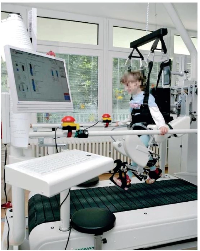 Roboticky- asistovaný lokomočný tréning v zariadení Lokomat<sup>®</sup>.
