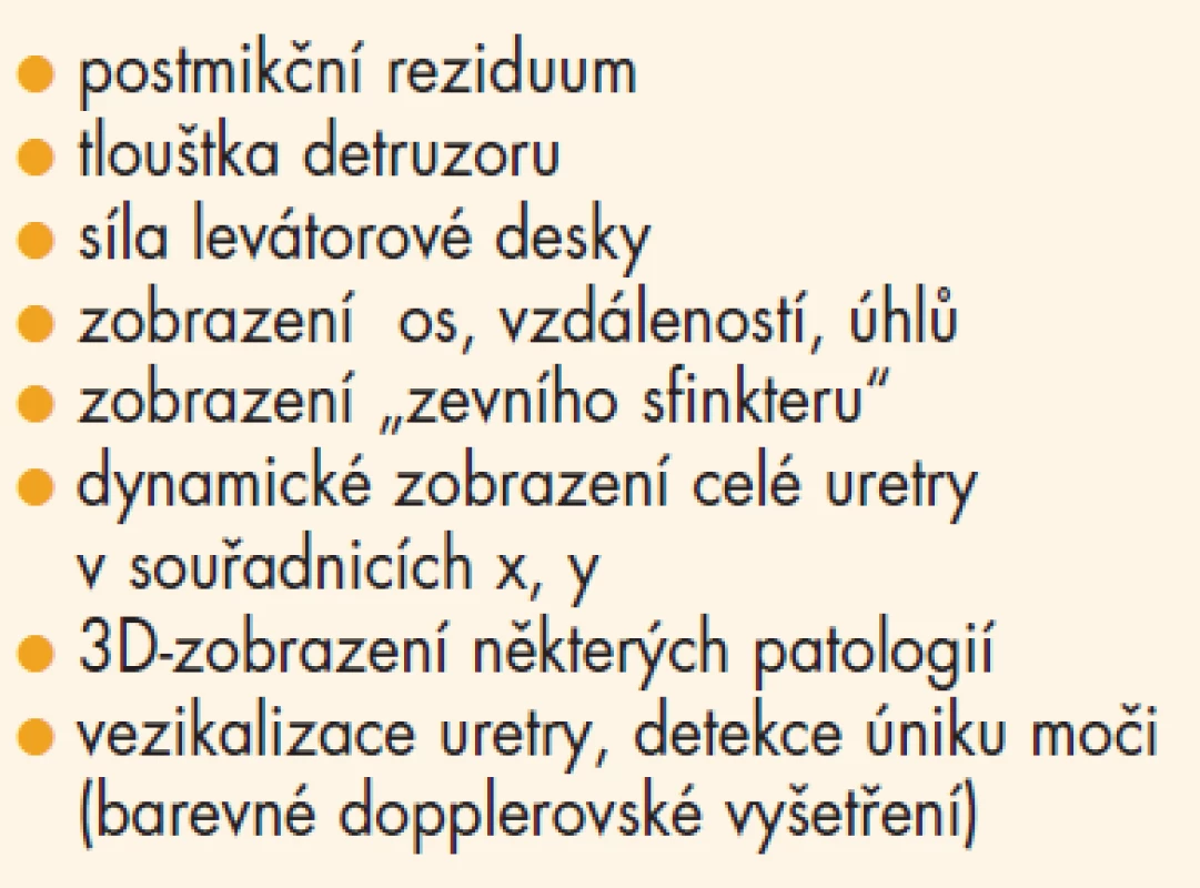 Možnosti ultrazvukové diagnostiky z pohledu gynekologa.