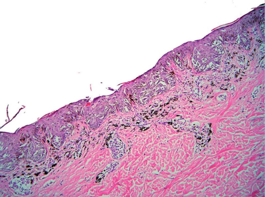 SSM in situ