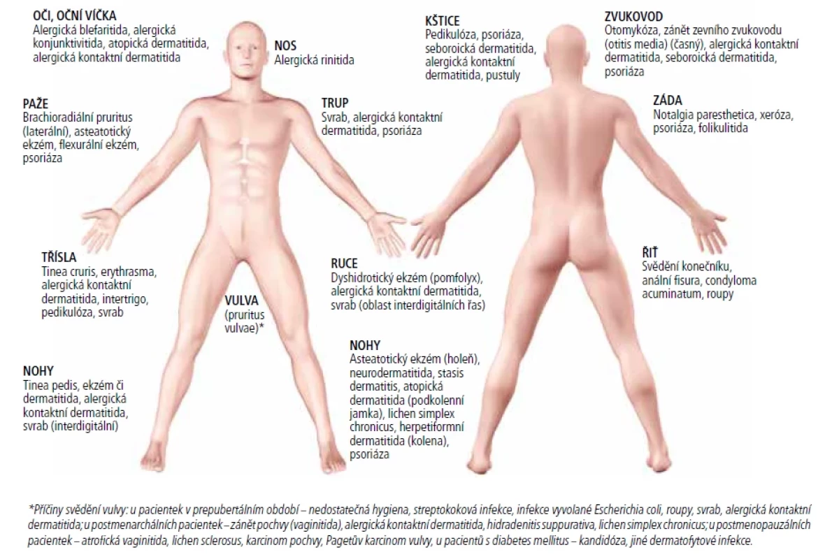 Pruritus na různých tělesných partiích odpovídá různým diagnozám.
