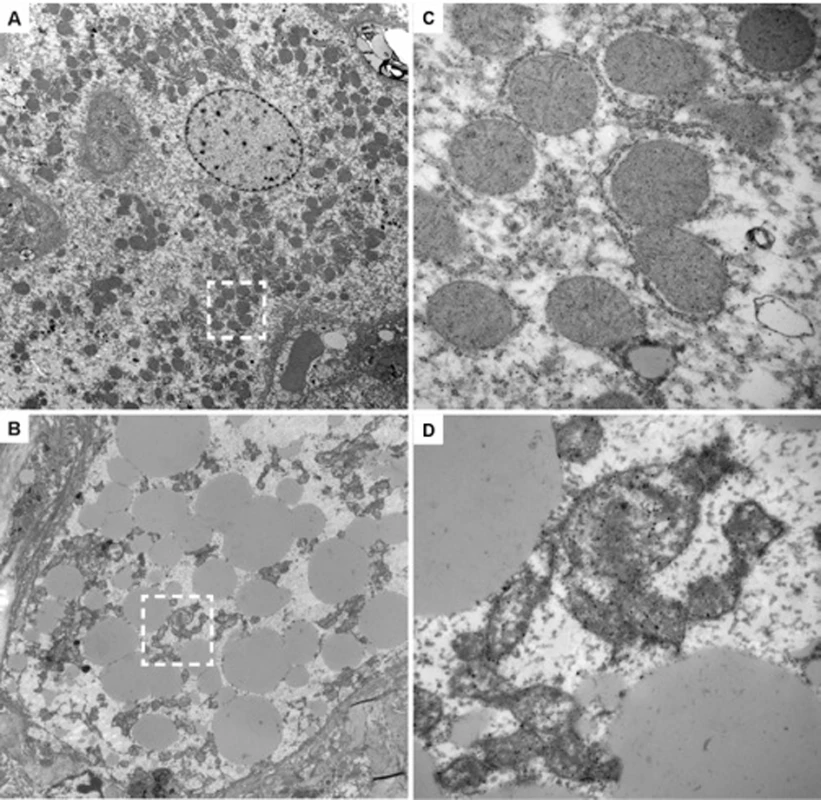 Ultra-structural changes induced by FIAU in TK-NOG mice with humanized livers.