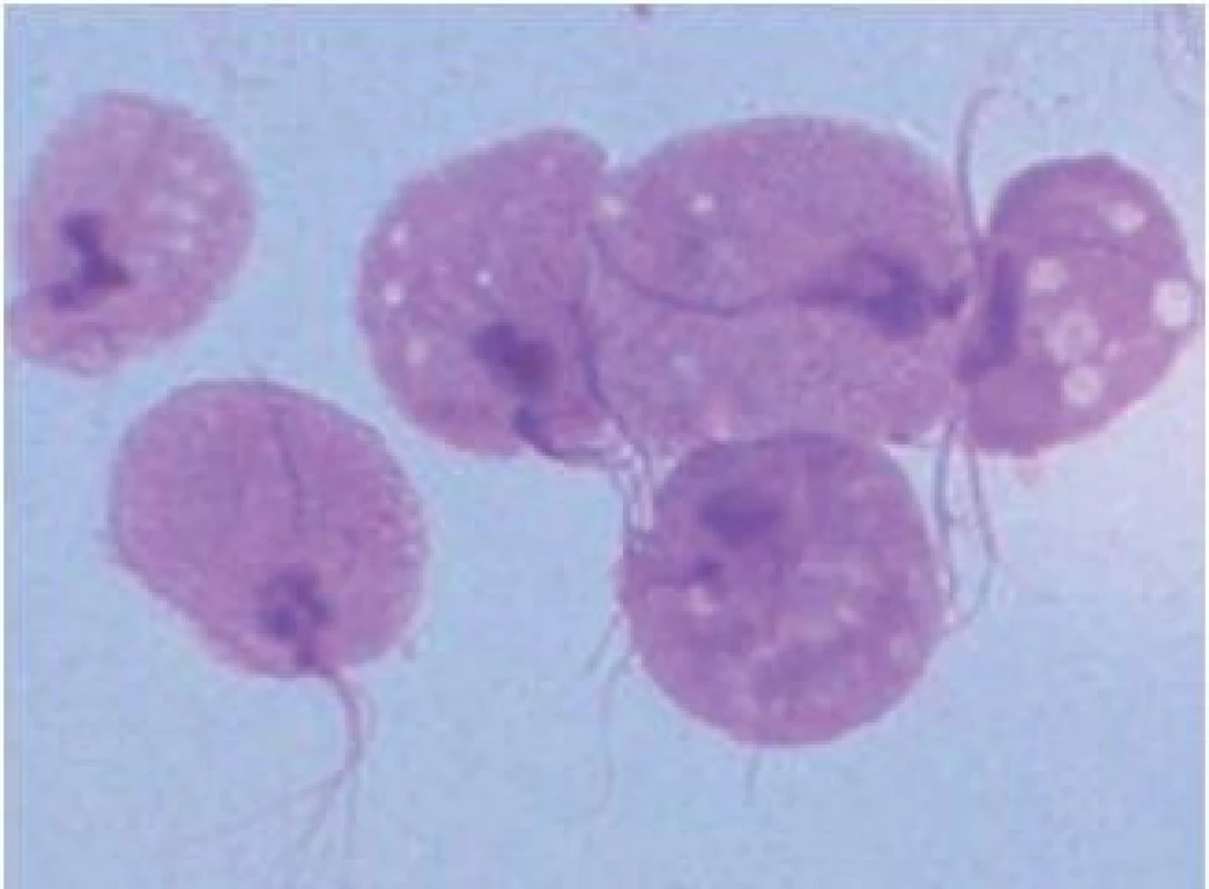 Trichomonas vaginalis.