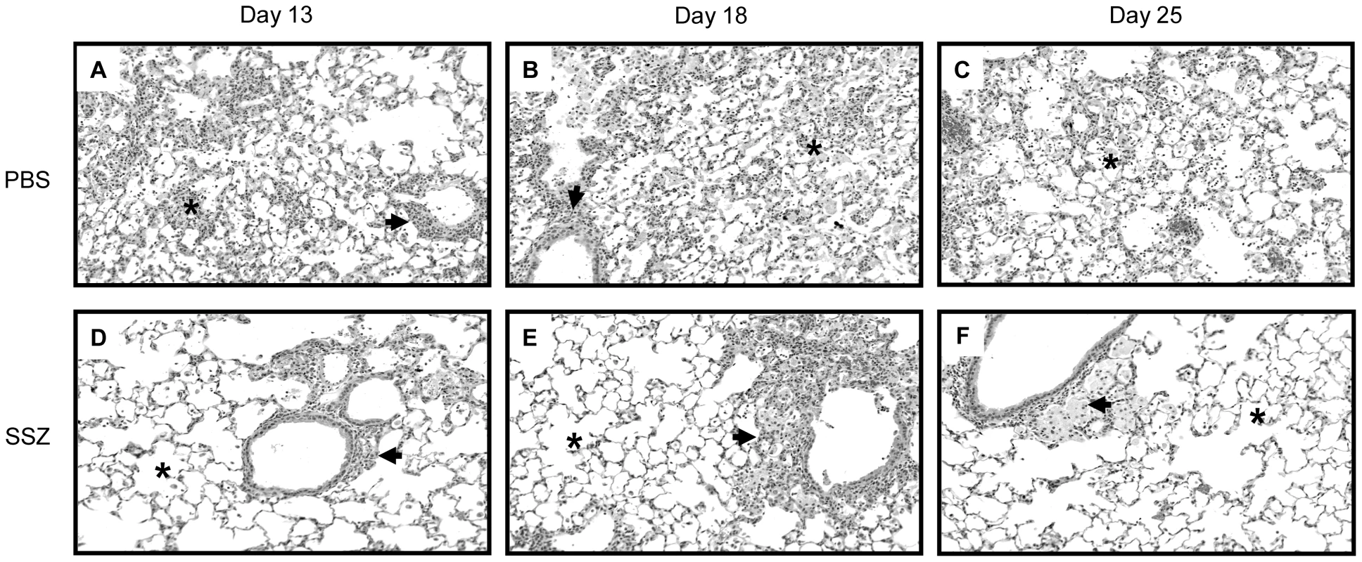 SSZ reduces pulmonary inflammation during PcP-related IRIS.