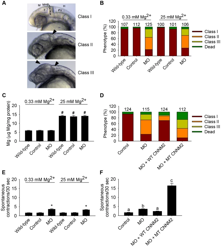 Dysfunctional c<i>nnm2b</i> causes brain abnormalities and increased spontaneous contractions in zebrafish embryos (25 hpf).