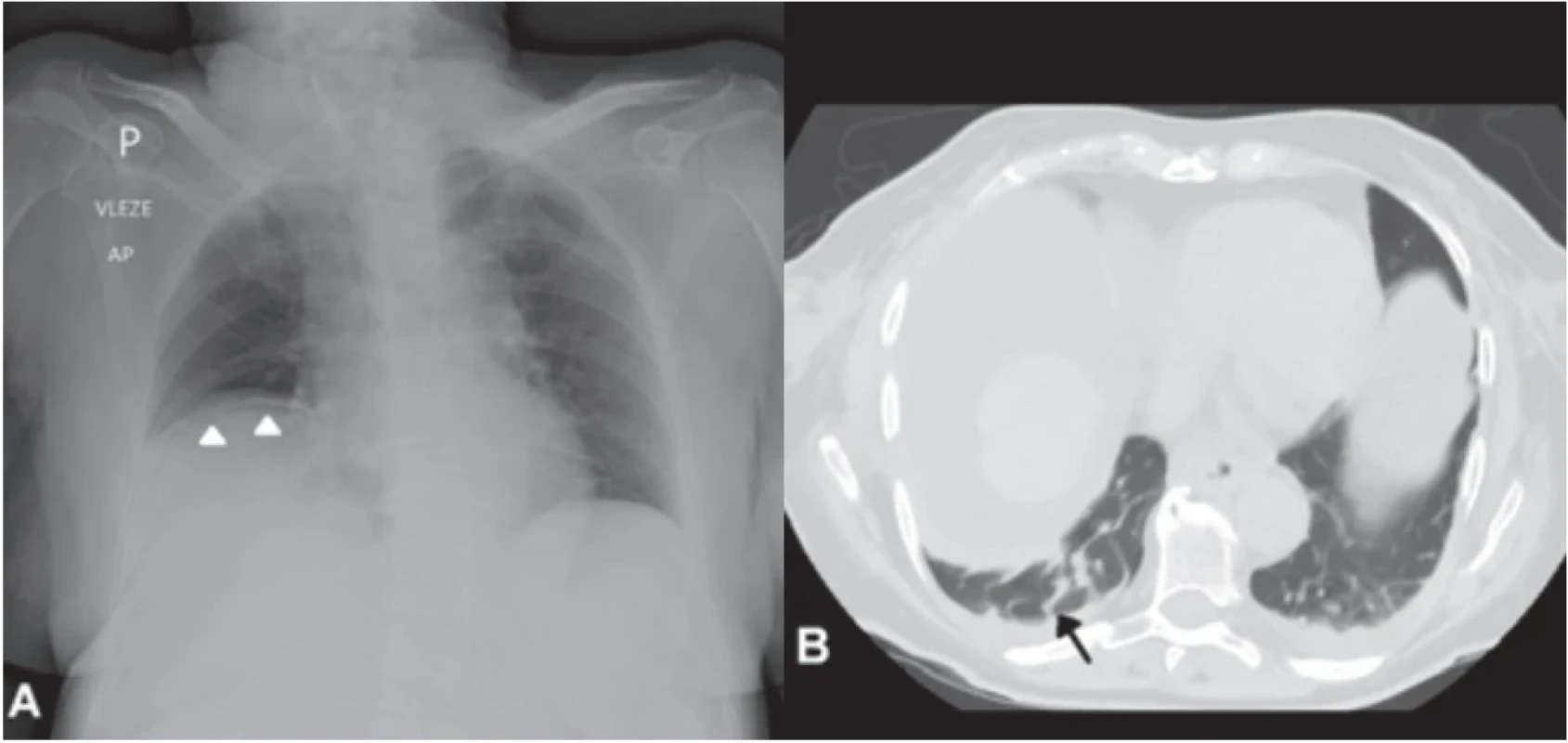  / Fig. 4.