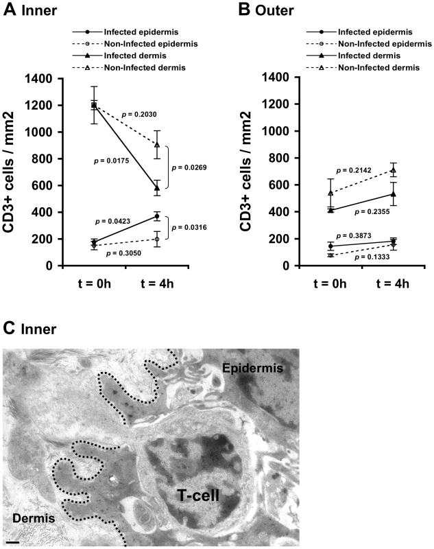 HIV-1-infected cells induce recruitment of T-cells into the epidermis.