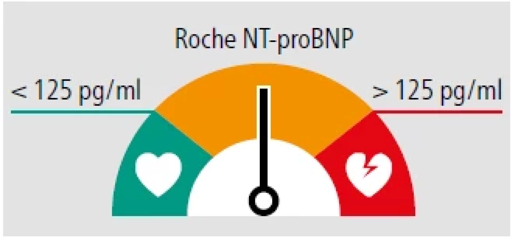 Pravděpodobnost srdečního selhání podle stanovení NT-proBNP v ambulanci všeobecného praktického lékaře POCT metodou.