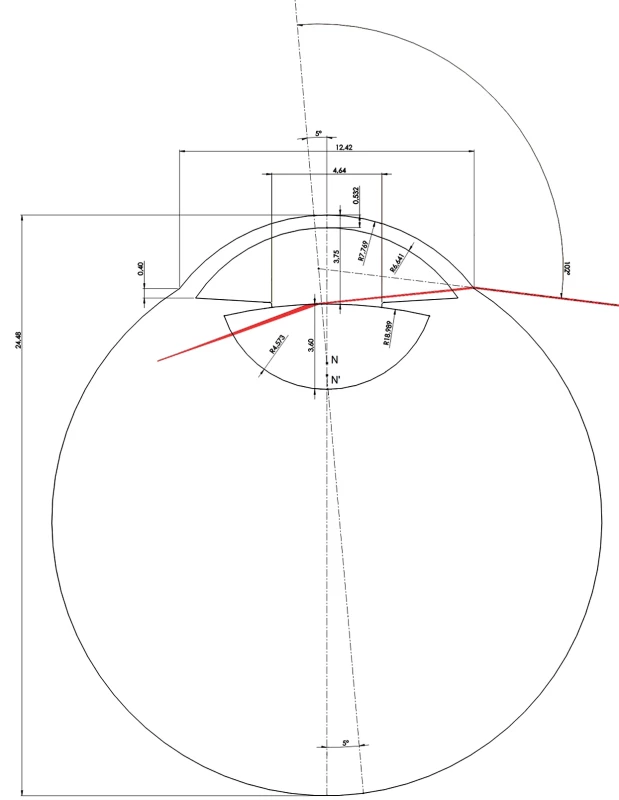 Modelling of the beam entering the eye at an angle of 102 degrees. Values are in mm and angular degrees. The axis of vision is displaced 5 degrees nasally from the axial axis of the eye. The pupil width is 4.64 mm [9]