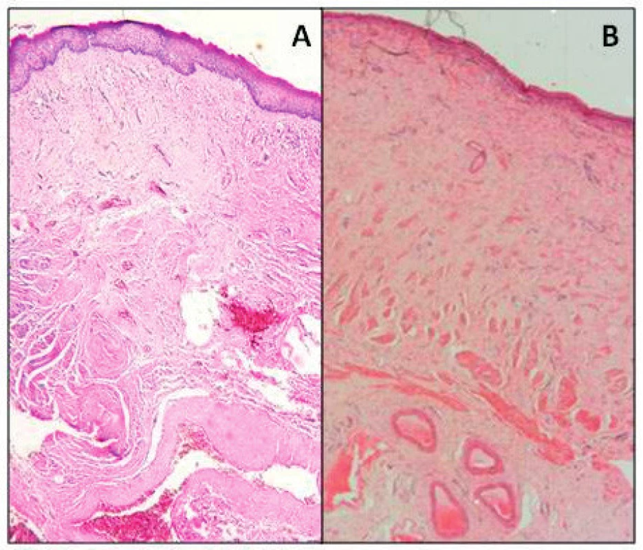 Histologická stavba poševní stěny u ženy (A) a u ovce (B)