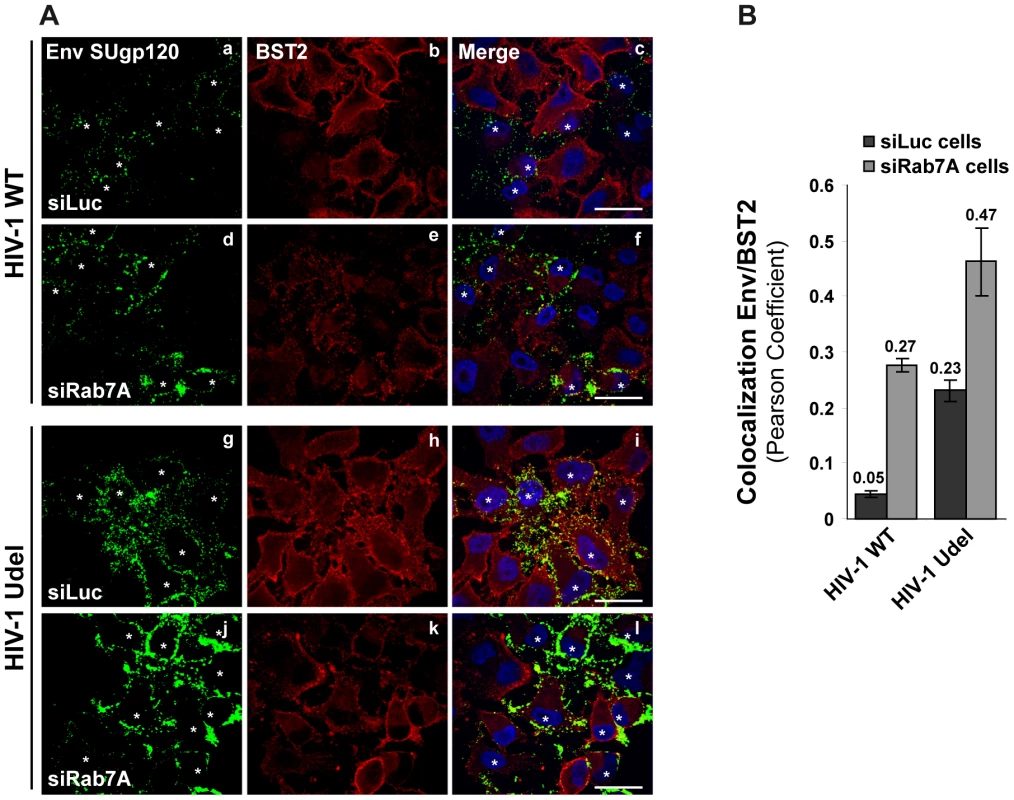 Env SUgp120 and BST2 proteins colocalize at the cell surface of Rab7A-depleted cells.