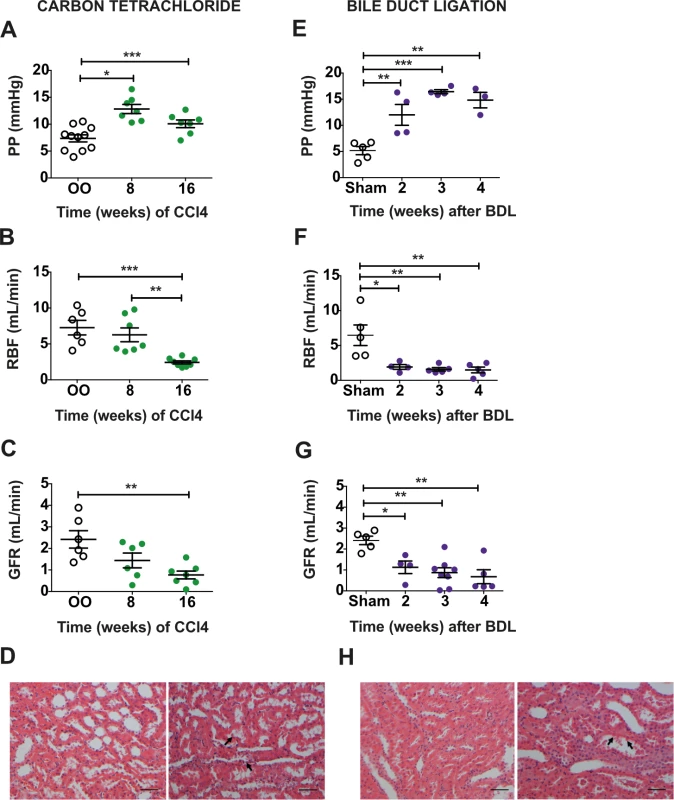 Rat models of advanced cirrhosis, portal hypertension, and renal dysfunction.